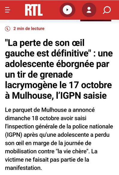 Article de RTL
La perte de son oeil est définitive : une adolescente eborgnée par un tir de grenade le 17 octobre à Mulhouse.
La victime ne faisait pas partie de la manifestation.